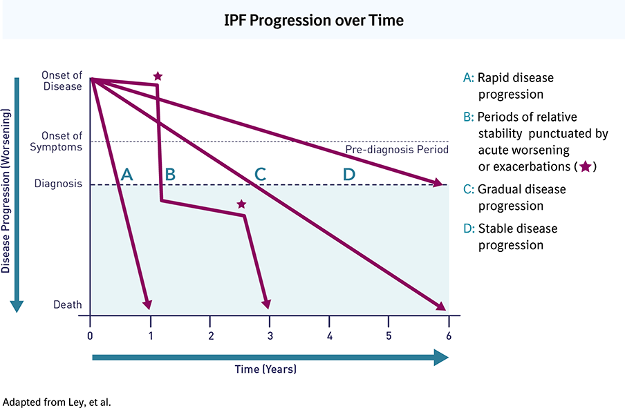 A graph describing IPF progression over time